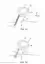 Fig. 02 - SPINAL DIAGNOSTIC METHODS AND APPARATUS