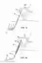 Fig. 07 - SPINAL DIAGNOSTIC METHODS AND APPARATUS