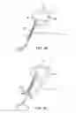 Fig. 09 - SPINAL DIAGNOSTIC METHODS AND APPARATUS