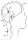 Fig. 01 - Methods and devices for treating obesity, incontinence, and neurological and physiological disorders