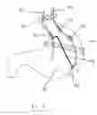 Fig. 09 - Methods and devices for treating obesity, incontinence, and neurological and physiological disorders
