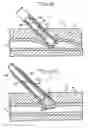 Fig. 06 - Device and method for sealing puncture wounds