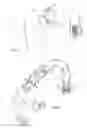 Fig. 02 - INTRAVASCULAR STIMULATION SYSTEM WITH WIRELESS POWER SUPPLY