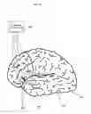 Fig. 03 - Treatment of language, behavior and social disorders