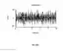 Fig. 22 - SYSTEM AND METHOD FOR NEURO-STIMULATION