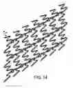 Fig. 22 - Expandable vascular endoluminal prostheses