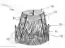 Fig. 01 - Aortic valve prosthesis having natural tissue and an internal cover