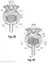 Fig. 08 - Intervertebral prosthesis endplate having double dome and surgical tools for implanting same