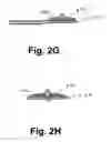 Fig. 09 - Intervertebral prosthesis endplate having double dome and surgical tools for implanting same