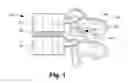 Fig. 02 - Intervertebral disc and facet joint prosthesis