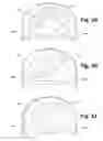 Fig. 08 - Intervertebral disc and facet joint prosthesis