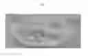 Fig. 02 - Muscle-based grafts/implants