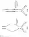 Fig. 07 - Methods and systems for making a blood vessel sleeve