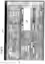 Fig. 16 - Tissue management system