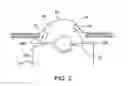 Fig. 03 - Variable valve timing mechanism for internal combustion engine