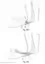 Fig. 07 - Pants cuff supports
