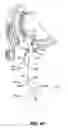 Fig. 10 - IMAGING APPARATUS WITH MOVEABLE ENTRANCE GUIDE