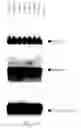 Fig. 14 - METHODS AND MICROORGANISMS FOR FORMING FERMENTATION PRODUCTS AND FIXING CARBON DIOXIDE
