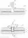 Fig. 01 - Method for repairing bonded metallic structures