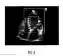 Fig. 03 - Component-Based Approach For Fast Left Ventricle Detection