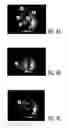 Fig. 04 - Component-Based Approach For Fast Left Ventricle Detection