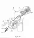 Fig. 07 - Percutaneous hip system