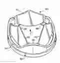 Fig. 01 - Mechanical heart valve