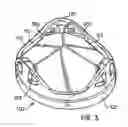 Fig. 09 - Mechanical heart valve