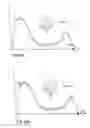 Fig. 33 - Mechanical heart valve