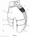 Fig. 02 - Safety gear