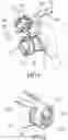 Fig. 03 - Adjustable multi-functional carrying strap for an ambu bag