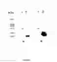 Fig. 06 - toxin, and process for the preparation of immunogenic composition