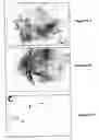 Fig. 46 - METHODS AND COMPOSITIONS FOR PROMOTING NORMAL CELL GROWTH AND INHIBITING CANCER CELL GROWTH