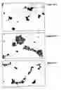 Fig. 49 - METHODS AND COMPOSITIONS FOR PROMOTING NORMAL CELL GROWTH AND INHIBITING CANCER CELL GROWTH