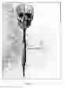 Fig. 02 - Dart