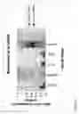 Fig. 43 - siRNA targeting complement component 3 (C3)