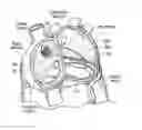 Fig. 01 - Devices, systems, and methods for reshaping a heart valve annulus, including the use of a bridge implant having an adjustable bridge stop