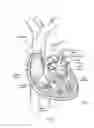 Fig. 02 - Devices, systems, and methods for reshaping a heart valve annulus, including the use of a bridge implant having an adjustable bridge stop