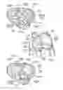 Fig. 03 - Devices, systems, and methods for reshaping a heart valve annulus, including the use of a bridge implant having an adjustable bridge stop