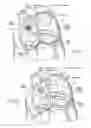 Fig. 07 - Devices, systems, and methods for reshaping a heart valve annulus, including the use of a bridge implant having an adjustable bridge stop