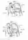 Fig. 08 - Devices, systems, and methods for reshaping a heart valve annulus, including the use of a bridge implant having an adjustable bridge stop