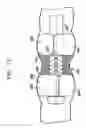 Fig. 22 - Endoscope assembly