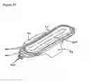 Fig. 08 - Automatic self cleaning bladder relief with diaper pad system