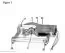 Fig. 12 - Automatic self cleaning bladder relief with diaper pad system
