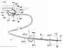 Fig. 01 - Catheter system with on-board temperature probe