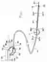 Fig. 02 - Catheter system with on-board temperature probe