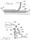 Fig. 05 - Catheter system with on-board temperature probe
