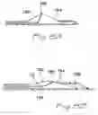 Fig. 06 - Catheter system with on-board temperature probe