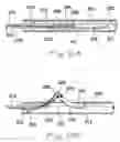 Fig. 08 - Catheter system with on-board temperature probe