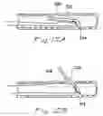 Fig. 09 - Catheter system with on-board temperature probe